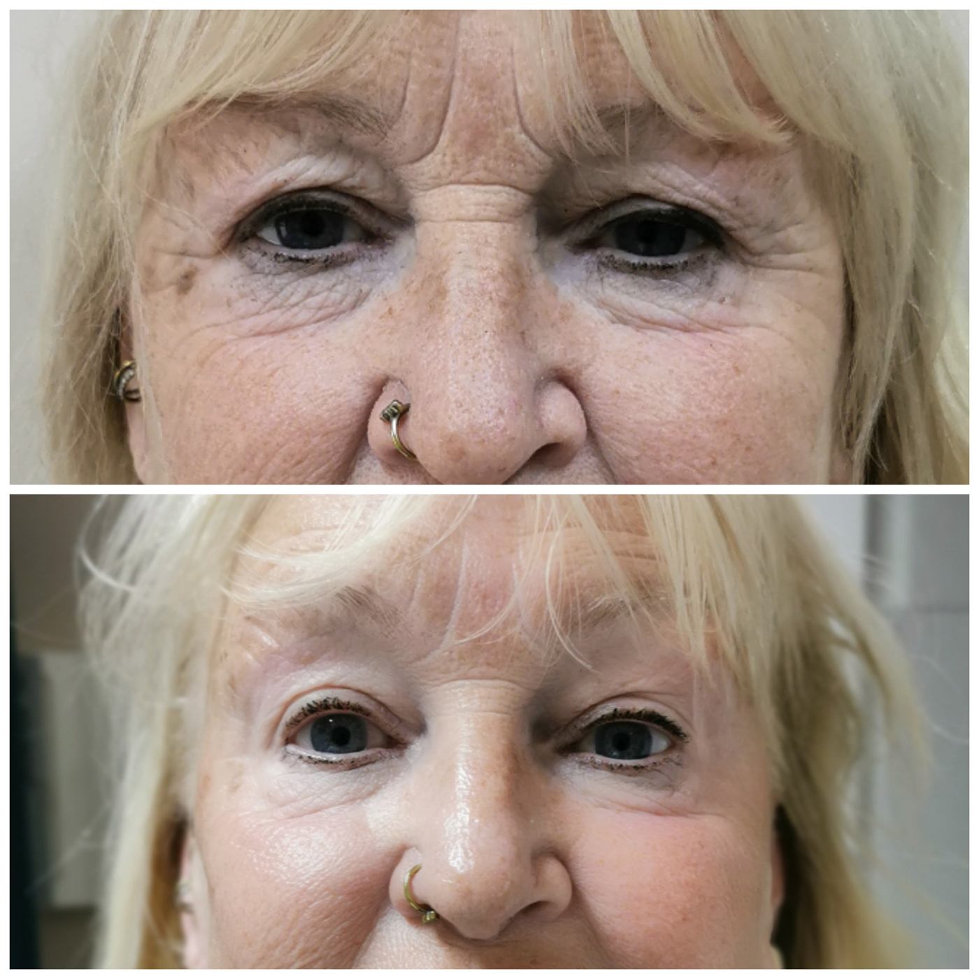 Vivena Massage before and after — facial contouring and tone improvement